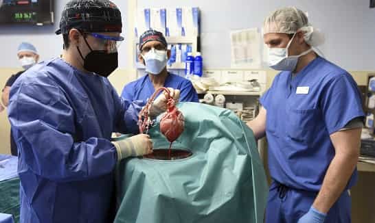 US surgeons successfully transplanted pig hearts into a human body