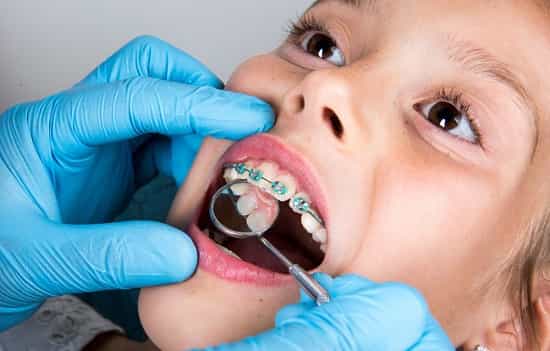 Orthodontic treatment for child