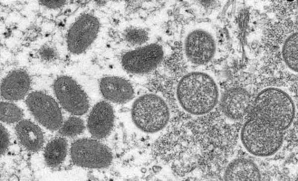 104-cases-of-the-monkeypox-virus UK has detected another 104 cases of the monkeypox virus