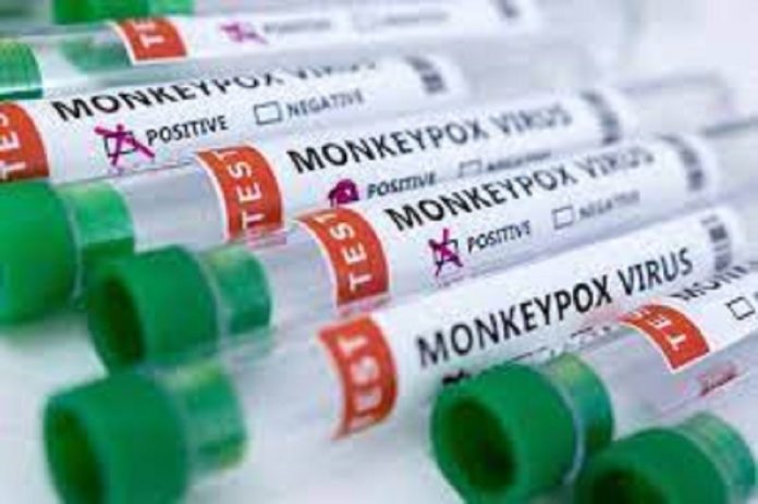 first-fatality-from-monkeypox-re First fatality from monkeypox reported in Los Angeles